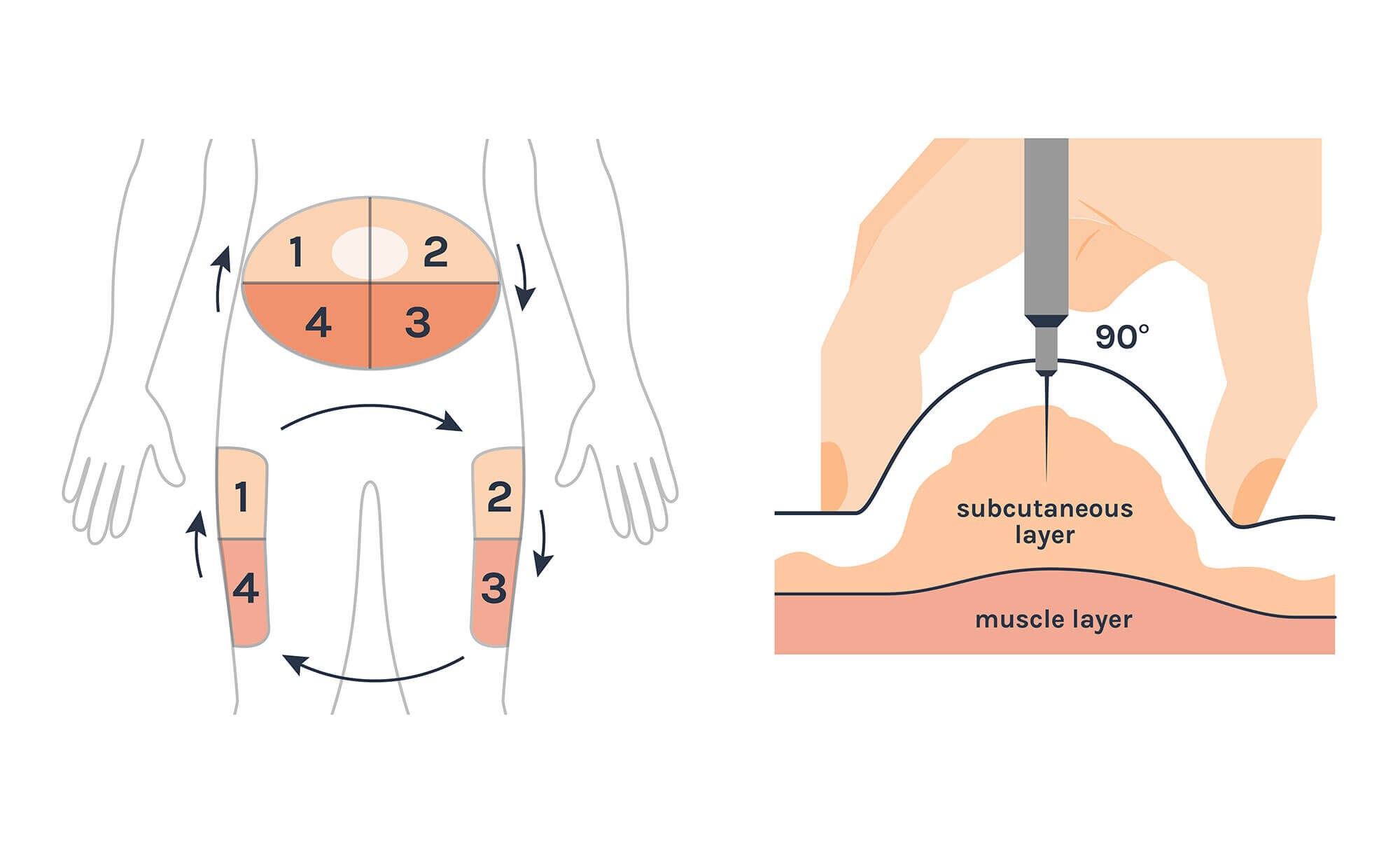 insulin injection sites