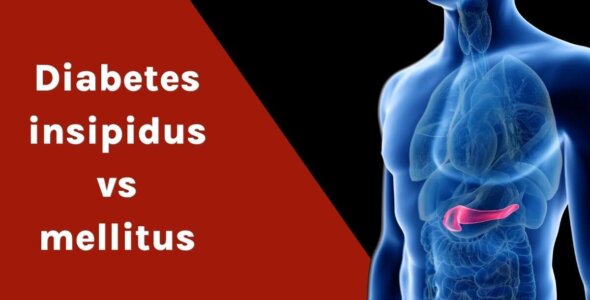 Diabetes insipidus vs mellitus