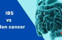IBS vs colon cancer