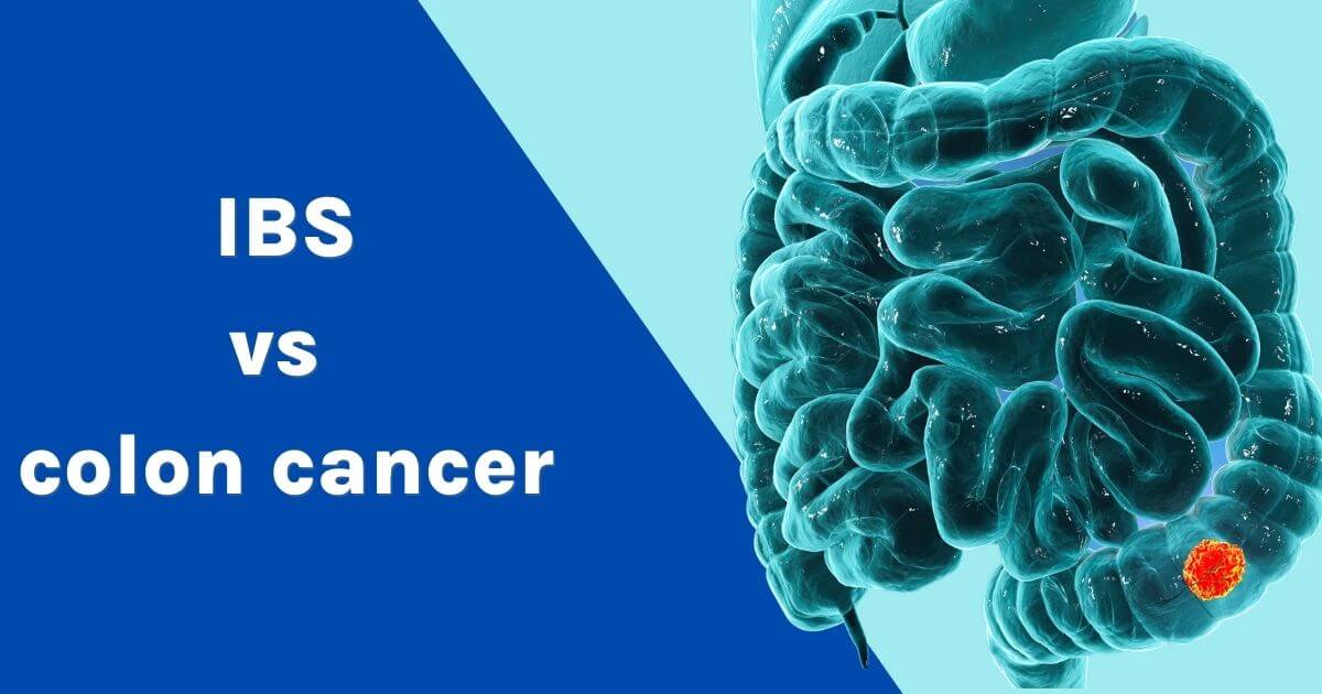 IBS vs colon cancer